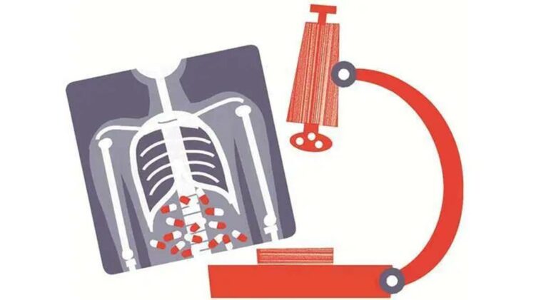 Tuberculosis, tuberculosis cases, COVID-19, Covid pandemic, Indian express, Opinion, Editorial, Current Affairs