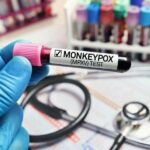 U.S. monkeypox cases are declining