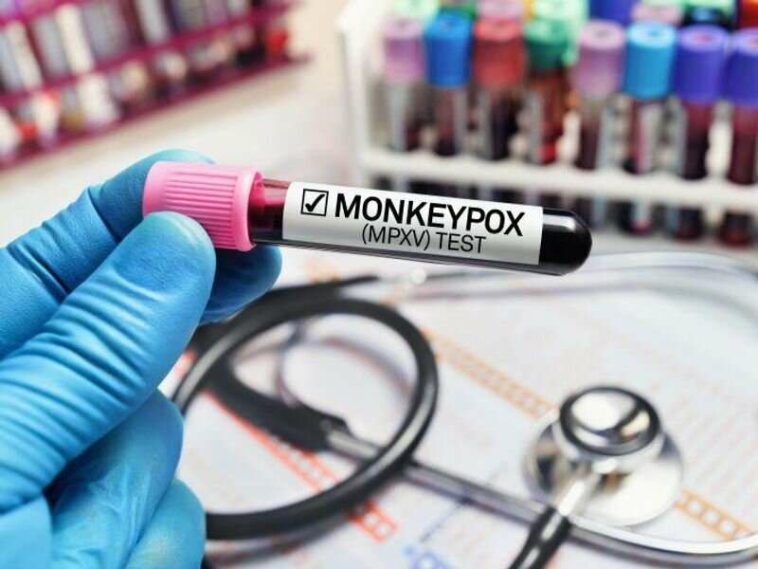 U.S. monkeypox cases are declining