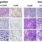 A new drug target for triple-negative breast cancer