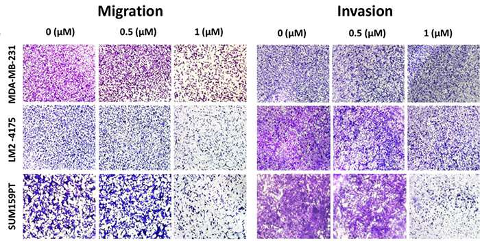 A new drug target for triple-negative breast cancer