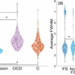 Functional, nonepileptic seizures show structural abnormalities in brain scans, study shows