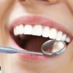 Is it safe to whiten my teeth with DIY kits? Should I only trust my dentist?