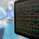 Hands-on cardiac education pays dividends for patients and others, says Abiomed