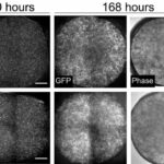 How a new blood-vessel-on-a-chip can help researchers further understand vascular malformations