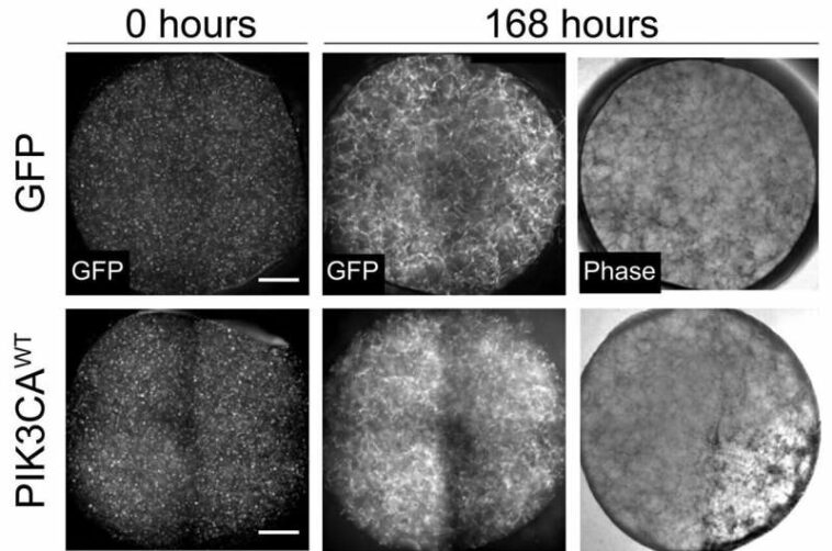 How a new blood-vessel-on-a-chip can help researchers further understand vascular malformations