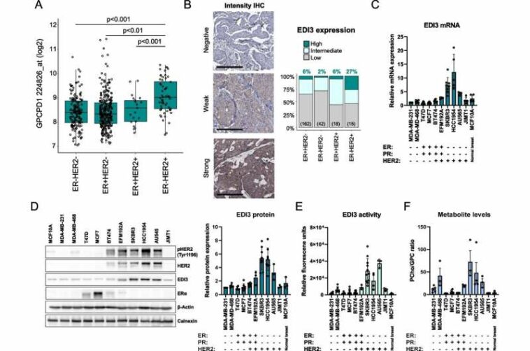 New potential therapeutic approach for HER2-positive breast cancer discovered