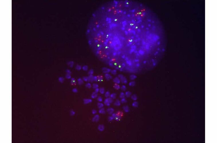 Scientists identify the mechanisms leading to resistance to lung cancer treatment with Sotorasib, the first KRAS inhibitor