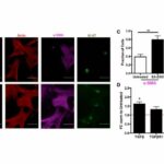 Aging | Senescence-associated exosomes transfer fibrosis to neighboring cells