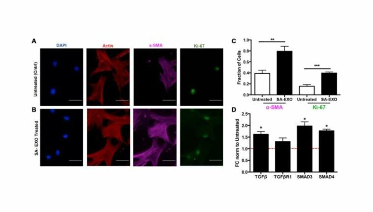 Aging | Senescence-associated exosomes transfer fibrosis to neighboring cells