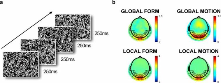 Study shows autism may be linked to different perceptions of movement in infancy