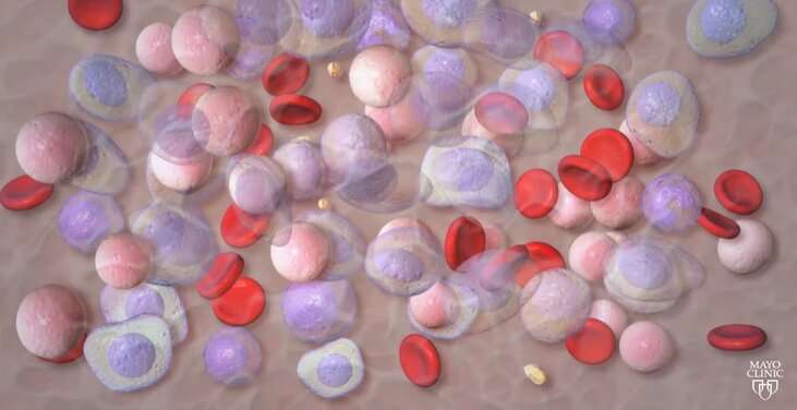 Video: What is multiple myeloma?