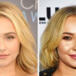 Hayden Panettiere Revealed That She Experienced Liver Failure While Battling Addiction