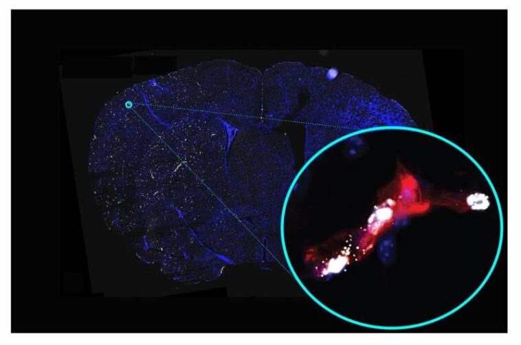 Study of cerebral blood vessels uncovers potential new drug targets for treating stroke