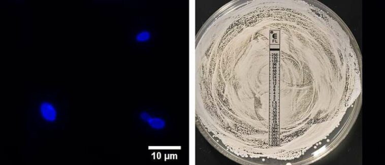 Resistant fungal species spreads