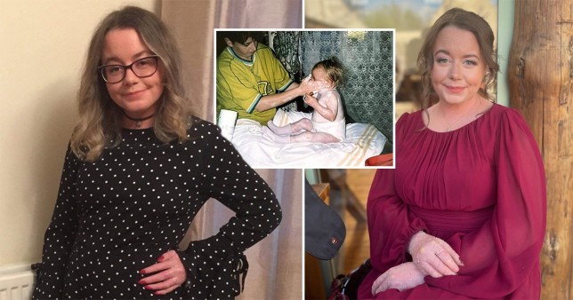 Rhiannon Morgan pictured in a polka dot dress, and a pink dress. In the middle there is a photo of her as a baby, having skin calming lotion applied