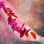 Study explores correlates of pain associated with sickle cell