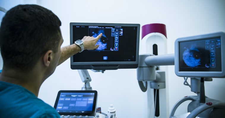 AI shows it can improve predictions for invasive breast cancer