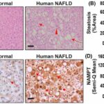 Inflammation-targeting antibody found to improve preterm birth outcomes, prevent obesity-linked liver disease