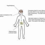 Rare leptin variants found in two children, leading to hyperphagia and obesity