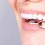 Smile! What are veneers and what do they do to your natural teeth?