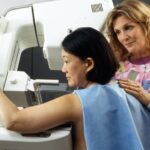 mammogram