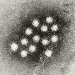 Hepatitis A