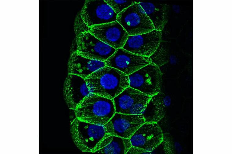 Fly toolkit created for investigating COVID-19 infection mechanisms