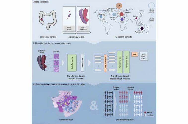 AI predictions for colorectal cancer: One step closer to efficient precision oncology