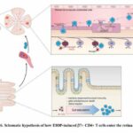 Association found between gut immune cells and eye damage from glaucoma