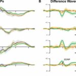 Attention is required for a popular brain signature of prediction error, researchers find