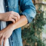 Young Man Scratching Forearm With Fingers