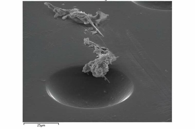 Microorganism that causes rare but severe eye infections detected in NSW coastal areas