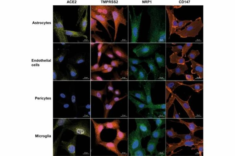 Scientists begin to untangle how COVID-19 affects brain cells