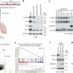 Uncovering the role of KDM6A in epigenetic regulation of subtype plasticity in small cell lung cancer