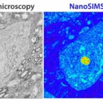 A deep look into the progression of Parkinson's Disease