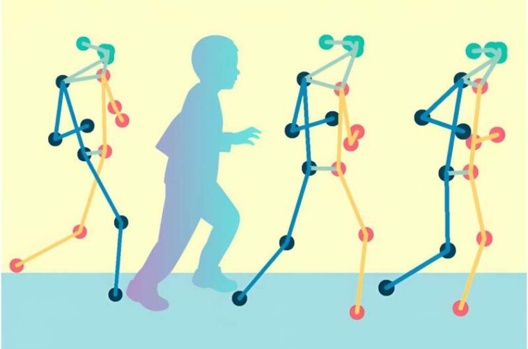 A pose-mapping technique could remotely evaluate patients with cerebral palsy