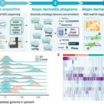 Atopic dermatitis: Viruses discovered as new therapy option