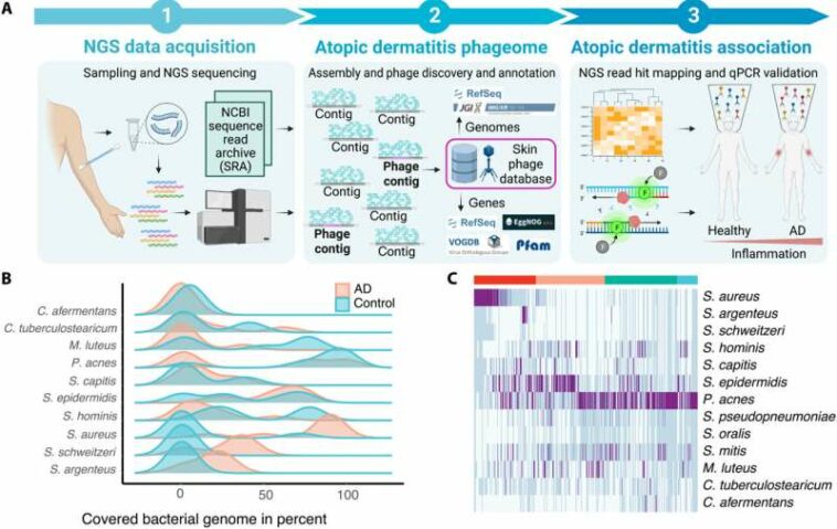 Atopic dermatitis: Viruses discovered as new therapy option