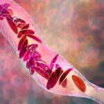 Gene-tweaked stem cells offer hope against sickle cell disease