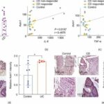 New research reveals gut microbiota link to colitis