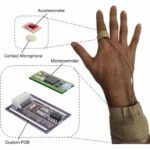 Carnegie Mellon University sensor objectively measures scratching intensity