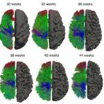 Q&amp;A: How new software is changing our understanding of human brain development