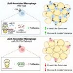 Study shows microRNAs in immune cells help protect against metabolic defects in obesity