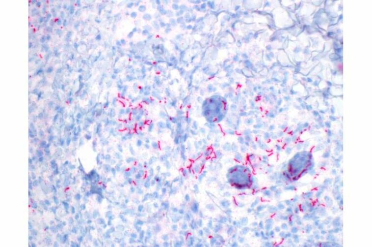 Syphilis transmission networks and antimicrobial resistance in England uncovered using genomics