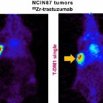 Pet imaging validates use of common cholesterol drug to enhance HER2-targeted cancer therapy