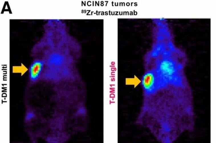 Pet imaging validates use of common cholesterol drug to enhance HER2-targeted cancer therapy