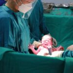 cesarean