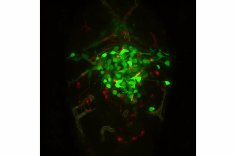 Avatars to help tailor glioblastoma therapies