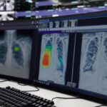 Growing adoption of AI CXR solution among APAC military hospitals and more briefs